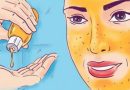 Užlašinkite 5 lašus ant rankos ir patrinkite veidą, kad nutrintumėte raukšles per 15 dienų